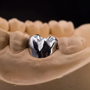 Fixed Restorations-Full Metal Crowns