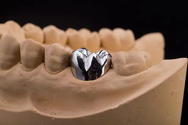 Fixed Restorations-Full Metal Crowns