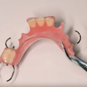 Removable Prosthetics-Partial Acrylic Dentures