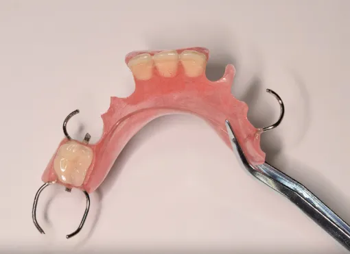 Removable Prosthetics-Partial Acrylic Dentures