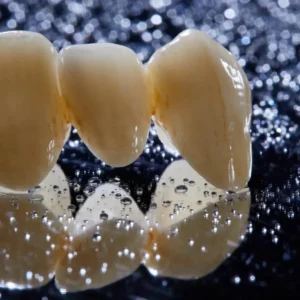 Fixed Restorations-Full‑Contour Zirconia Crowns