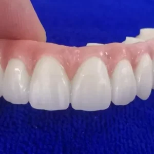 Fixed Restorations-Layered Zirconia