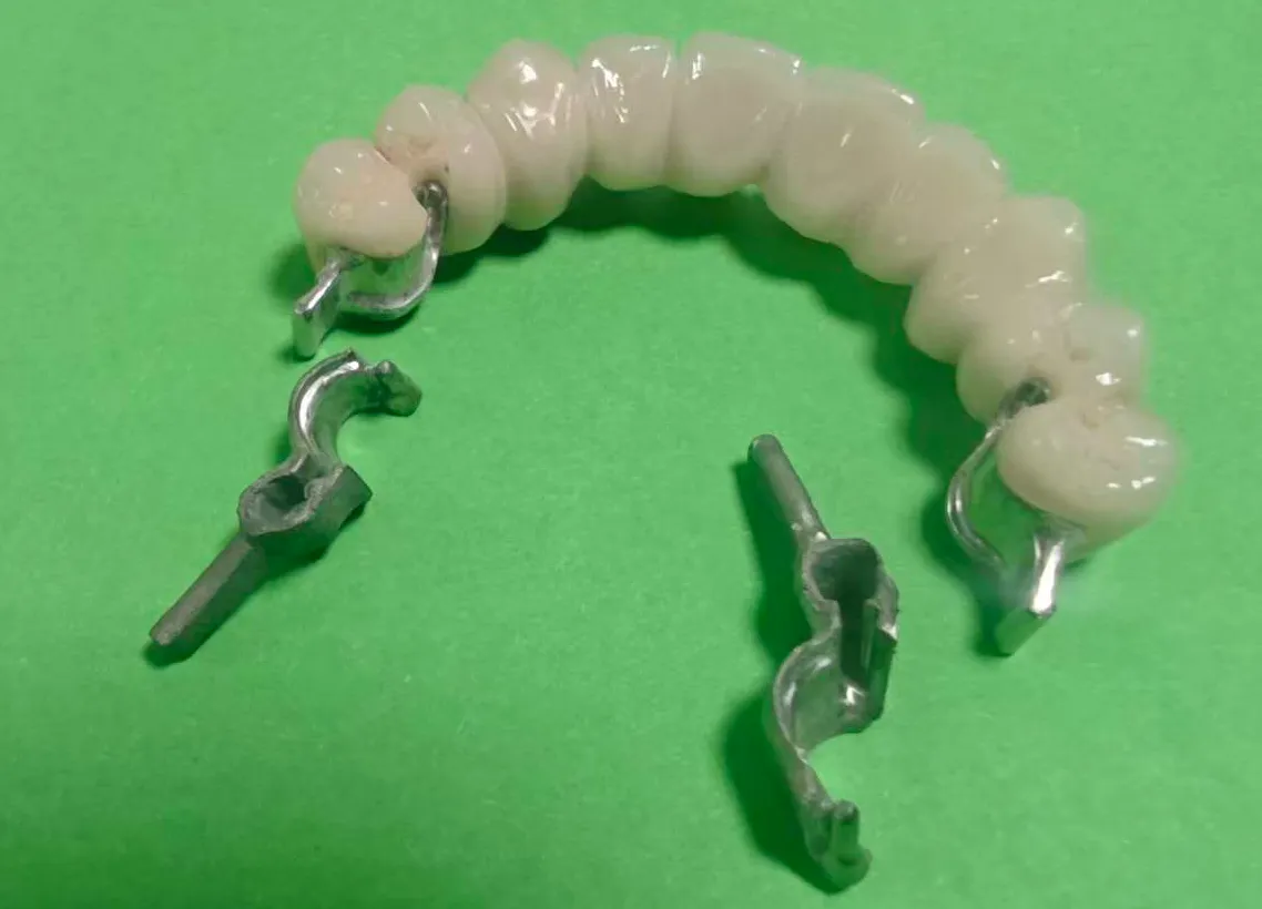 Implant‑Supported Restorations-Locator OT Equator Attachments