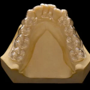 Orthodontic & Other Devices-Retainers